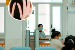 白斑做皮肤镜镜准确吗为什么