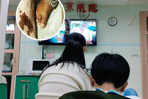 卤米松和曲咪新哪个效果好